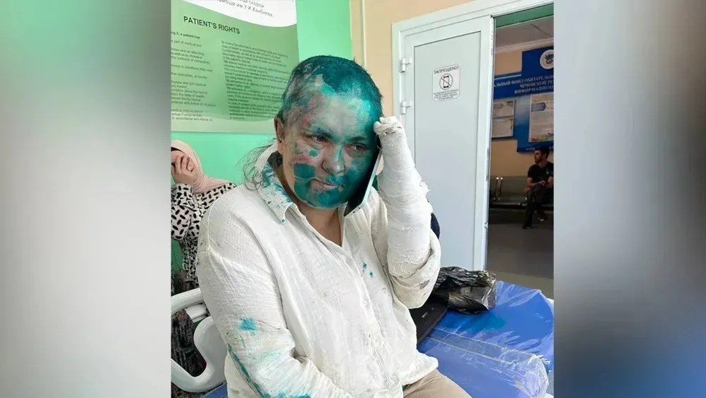 Jornalista russa é espancada na Chechênia e atingida com substância verde no rosto